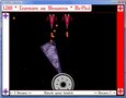 Deflector Beam