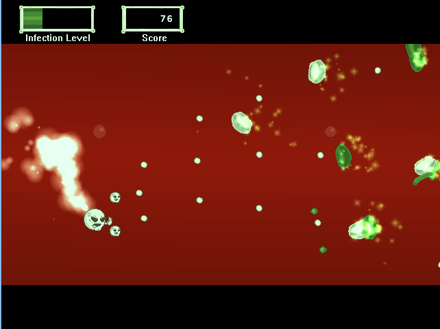 Sepsis