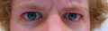 Staring Contest
