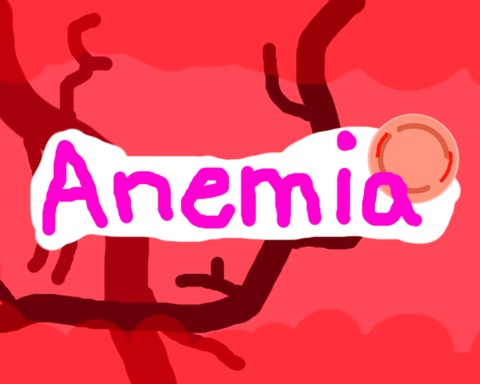 Anemia