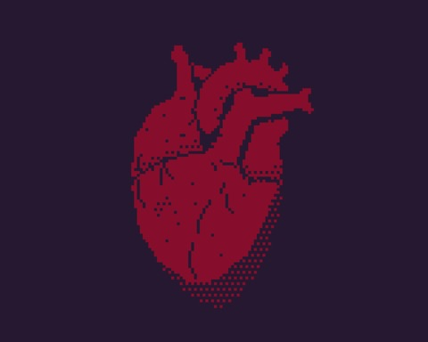 Arrhythmia