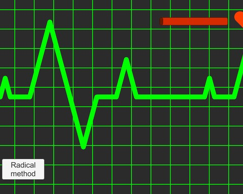 ECG - Electro Cardio Goblins