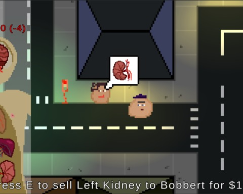Organ Sale