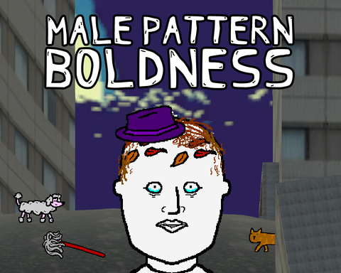 Male Pattern Boldness