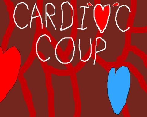 Cardiac Coup