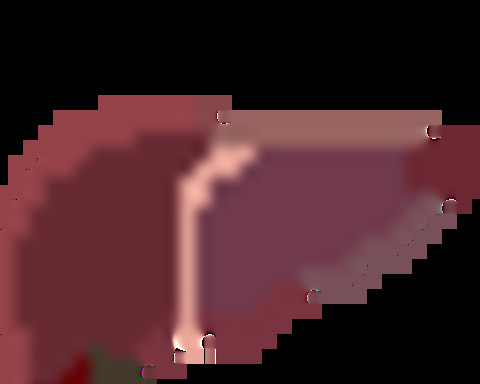 De-Liver-y