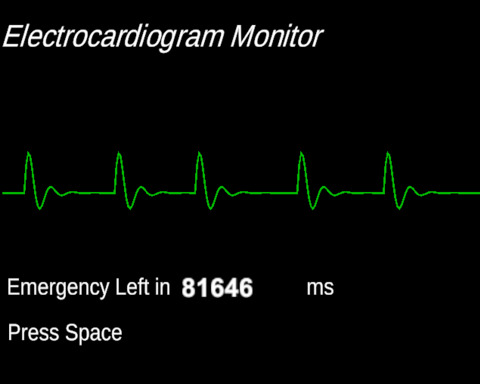 heartbeat