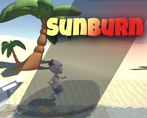 Sunburn