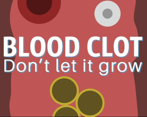 Blood Clot