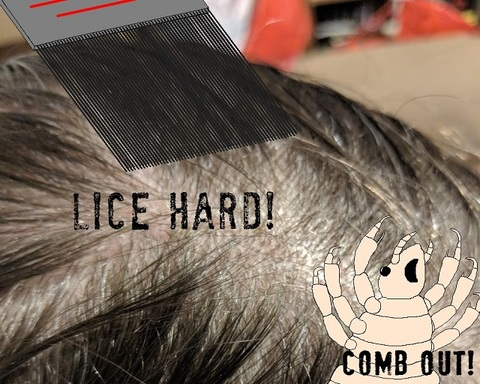 Lice Hard